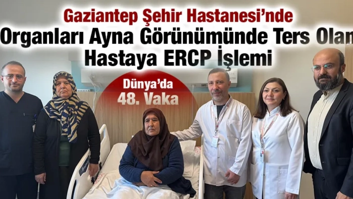 Dünya’da 48. Vaka: Organları Ayna Görünümünde Ters Olan Hastadan Safra Kanalındaki Taşlar Endoskopik Yöntemle Çıkarıldı