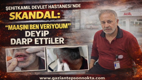 Şehitkamil Devlet Hastanesi’nde Skandal: "Maaşını Ben Veriyorum" Deyip Darp Ettiler